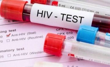 Zahl der Menschen mit HIV in Aserbaidschan