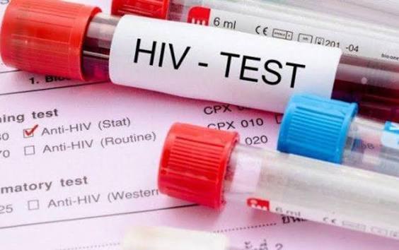 Zahl der Menschen mit HIV in Aserbaidschan