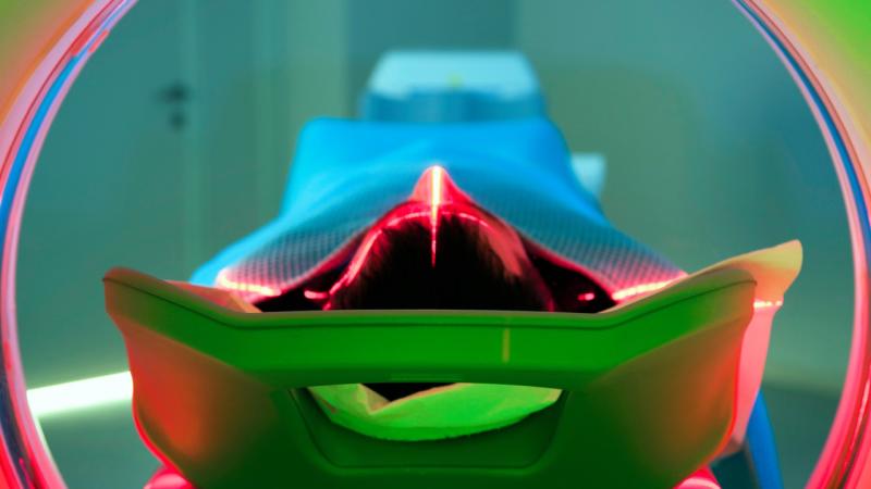 Krebsfälle unter jungen Menschen nehmen zu